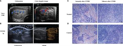 Ultrasound-Targeted Microbubble Destruction Alleviates Immunosuppression Induced by CD71+ Erythroid Progenitor Cells and Promotes PDL-1 Blockade Immunotherapy in the Lewis Lung Cancer Model